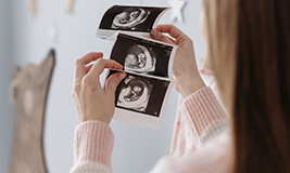 pictures-of-babies sonography