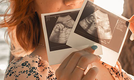 a mother holding two sonography pictures